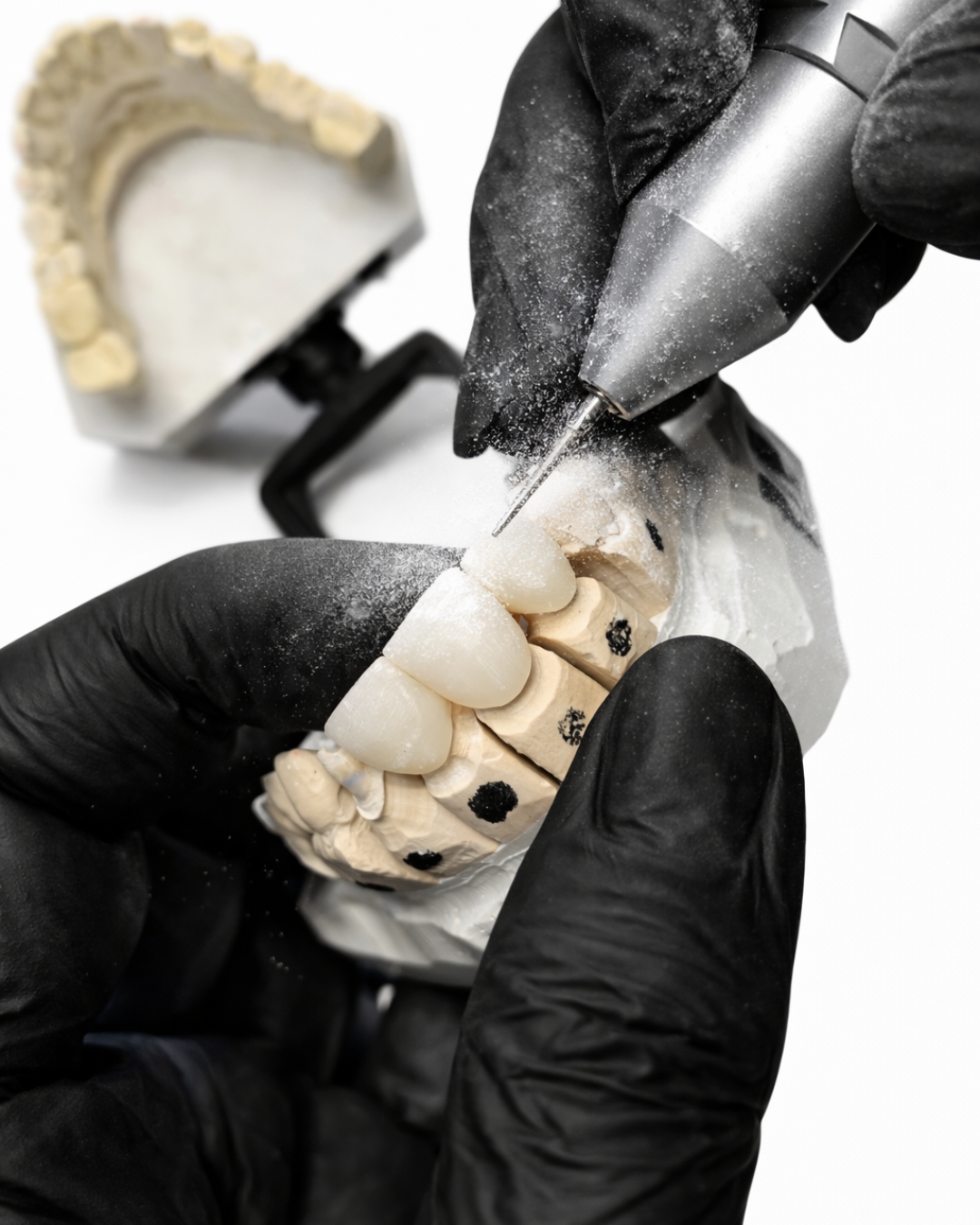PFM Crown  -  materials